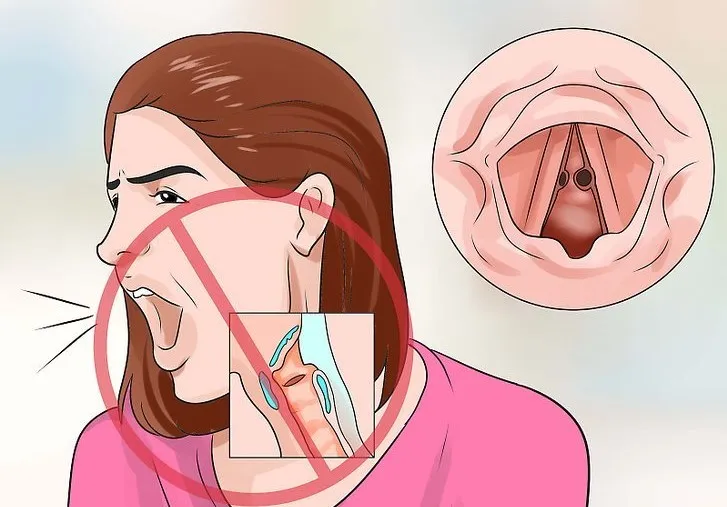 Детальный вид узелка голосовой связки